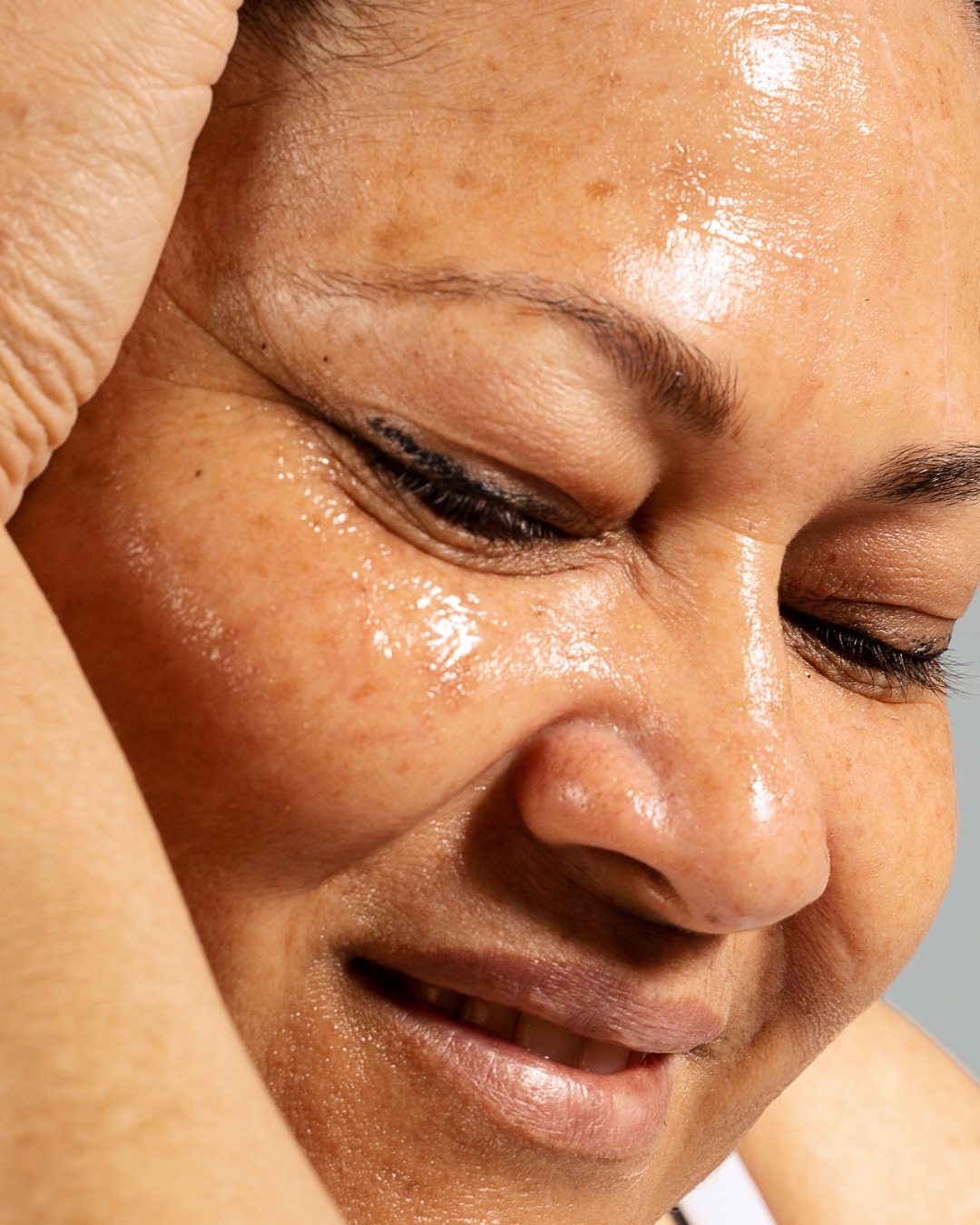 Pigmentation skin concern